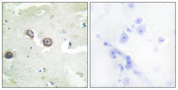 Immunohistochemistry analysis of paraffin-embedded human brain tissue, using CDH4 Antibody