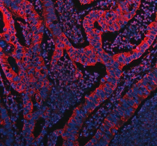 a07633 pla2g10 primary antibodies if testing 1