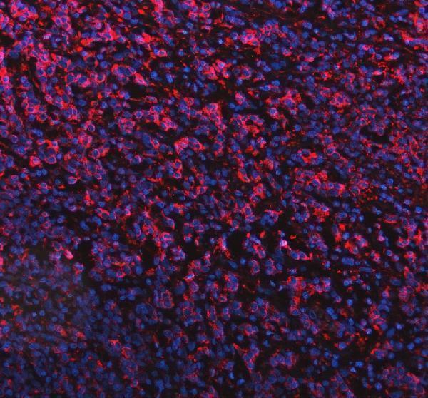 a07633 pla2g10 primary antibodies if testing 2