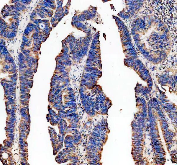 IHC analysis of PLA2G10 using anti-PLA2G10 antibody (A07633)