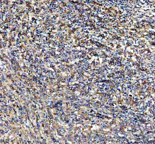 IHC analysis of PLA2G10 using anti-PLA2G10 antibody (A07633)