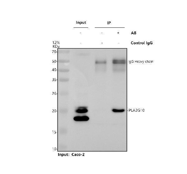 a07633 pla2g10 primary antibodies ip testing 1
