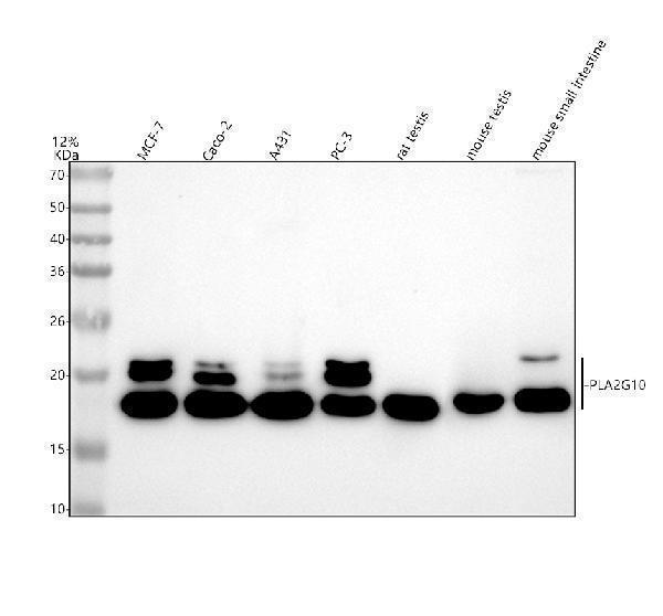 Western blot analysis of PLA2G10 using anti-PLA2G10 antibody (A07633)