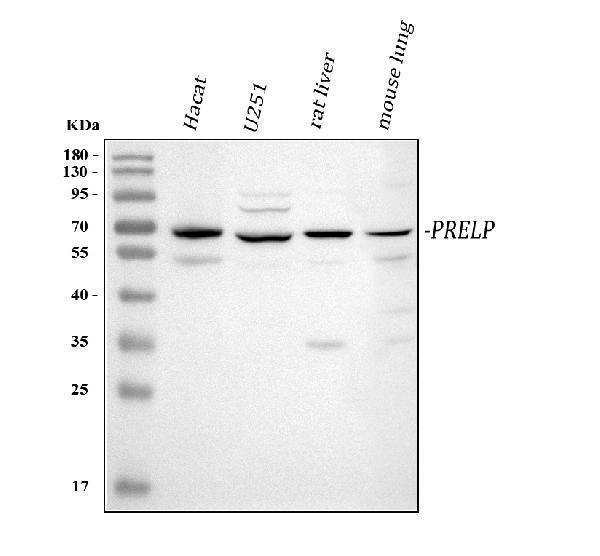  Western blot analysis of PRELP using anti-PRELP antibody (A07640-1)