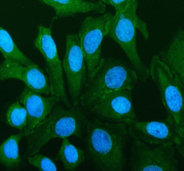 IF analysis of GIMAP5 using anti-GIMAP5 antibody (A07653-2)