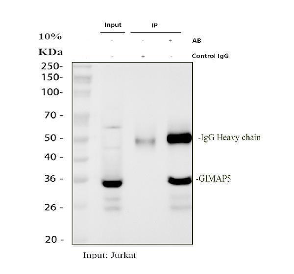 Immunoprecipitating (IP) GIMAP5 in Jurkat whole cell lysate