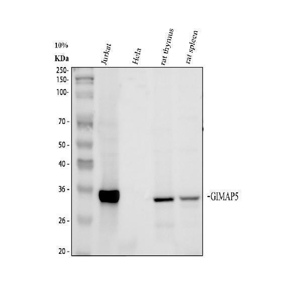 Western blot analysis of GIMAP5 using anti-GIMAP5 antibody (A07653-2)