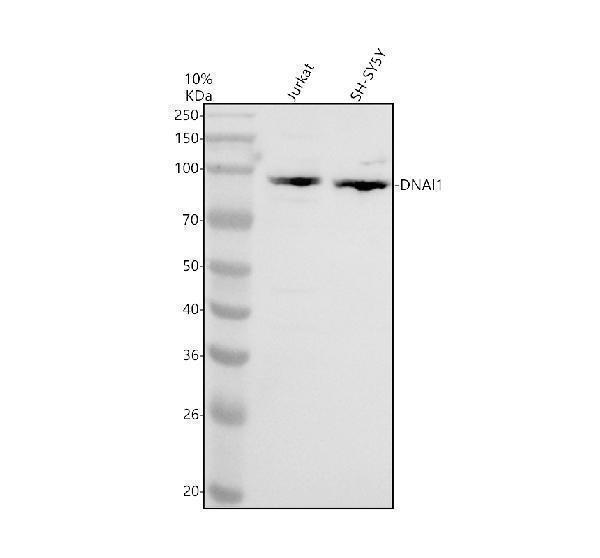 Western blot analysis of DNAI1 using anti-DNAI1 antibody (A07656-2)