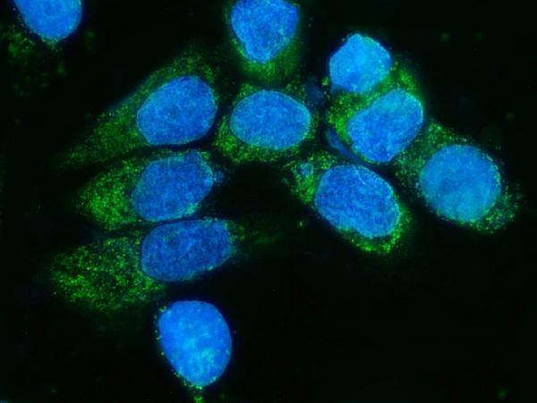 a07659 1 timm8a primary antibodies if testing 9