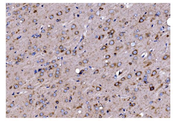 a07659 1 timm8a primary antibodies ihc testing 10