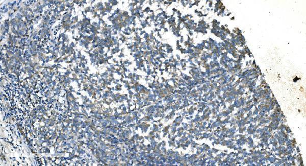a07659 1 timm8a primary antibodies ihc testing 2