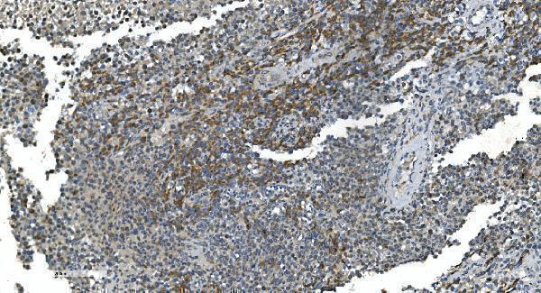 a07659 1 timm8a primary antibodies ihc testing 3