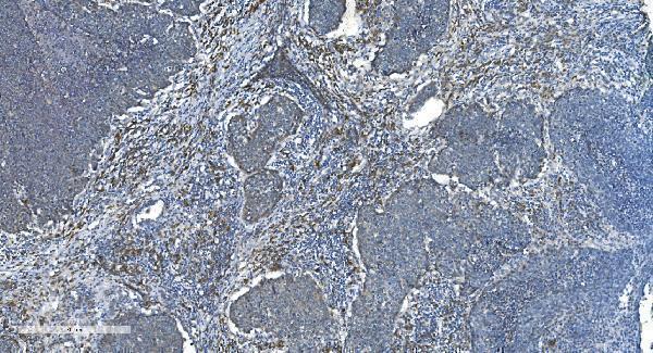 a07659 1 timm8a primary antibodies ihc testing 4