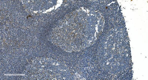 a07659 1 timm8a primary antibodies ihc testing 5