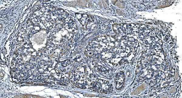 a07659 1 timm8a primary antibodies ihc testing 6