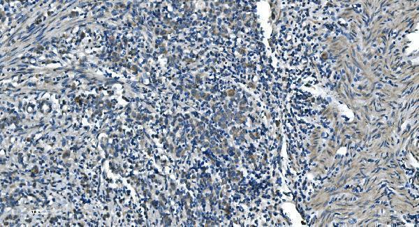 a07659 1 timm8a primary antibodies ihc testing 7