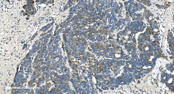 a07659 1 timm8a primary antibodies ihc testing 8