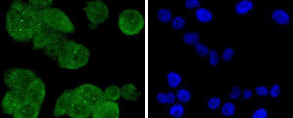 a07661 1 ppp2cb primary antiboties icc testing 2