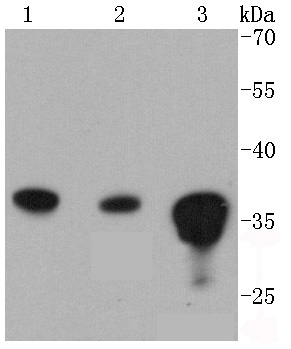a07661 1 ppp2cb primary antiboties wb testing 1