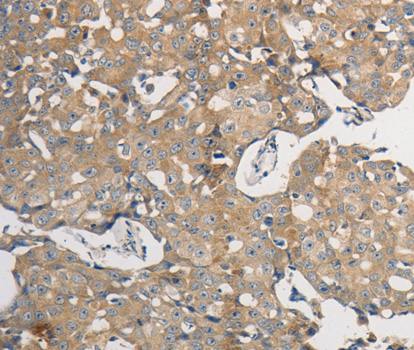 a07661 ppp2cb primary antiboties ihc testing 2
