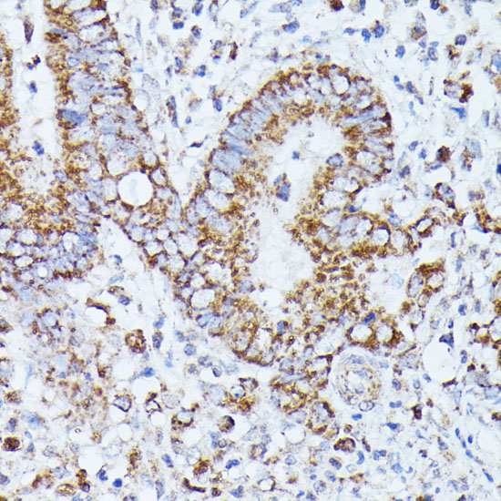 a07661 ppp2cb primary antiboties ihc testing 3