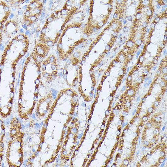 a07661 ppp2cb primary antiboties ihc testing 4