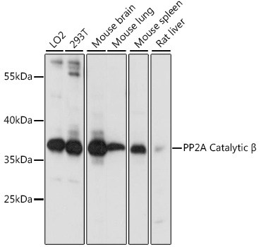 a07661 ppp2cb primary antiboties wb testing 1
