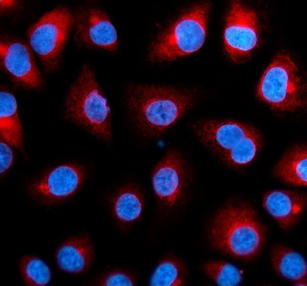 a07663 1 ercc6l primary antibodies if testing 1