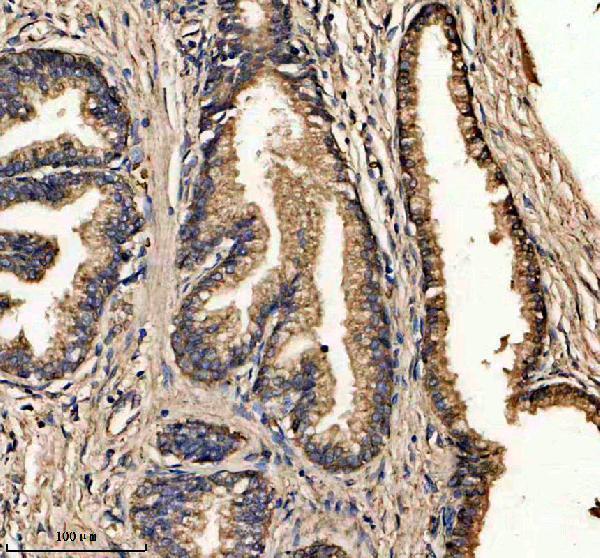IHC analysis of CAPZA1 using anti-CAPZA1 antibody (A07665-1)