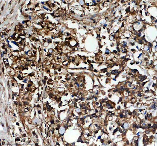 IHC analysis of CAPZA1 using anti-CAPZA1 antibody (A07665-1)