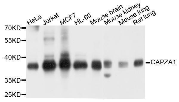 Western blot analysis of extracts of various cell lines, using CAPZA1 antibody at 1:1000 dilution