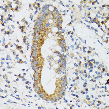 Immunohistochemistry of paraffin-embedded human vermiform appendix using SRP19 antibody  at dilution of 1:100 