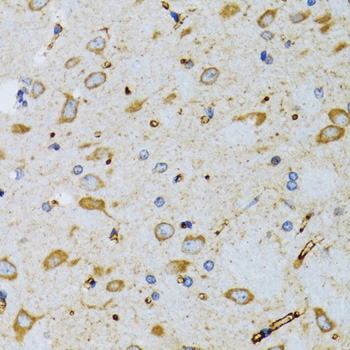 a07666 srp19 primary antiboties ihc testing 4