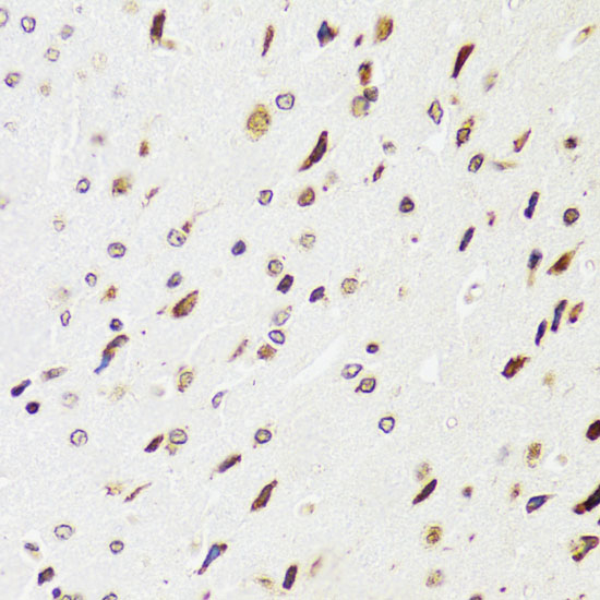 Immunohistochemistry of paraffin-embedded rat brain using EDF1 antibody  at dilution of 1:100 