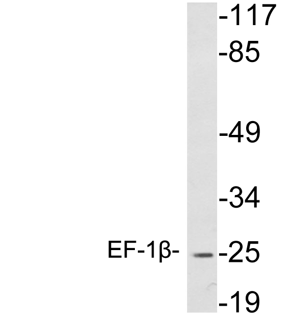 Western blot analysis of lysates from K562 cells , using EF-1β antibody