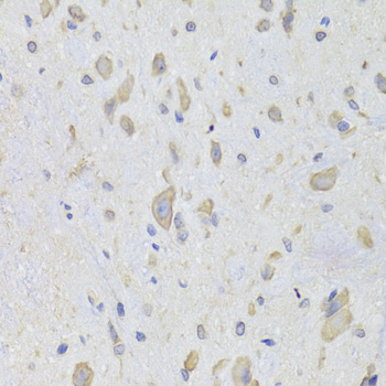 Immunohistochemistry of paraffin-embedded rat spinal cord using EEF1B2 Antibody  at dilution of 1:100 