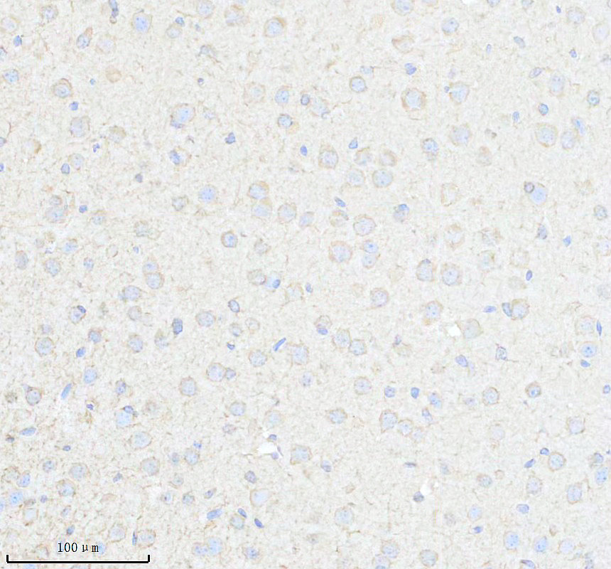 IHC analysis of EEF1B2 using anti-EEF1B2 antibody (A07669-3)