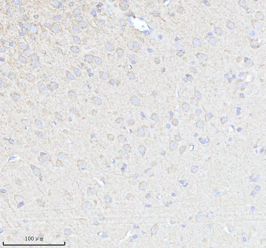 IHC analysis of EEF1B2 using anti-EEF1B2 antibody (A07669-3)