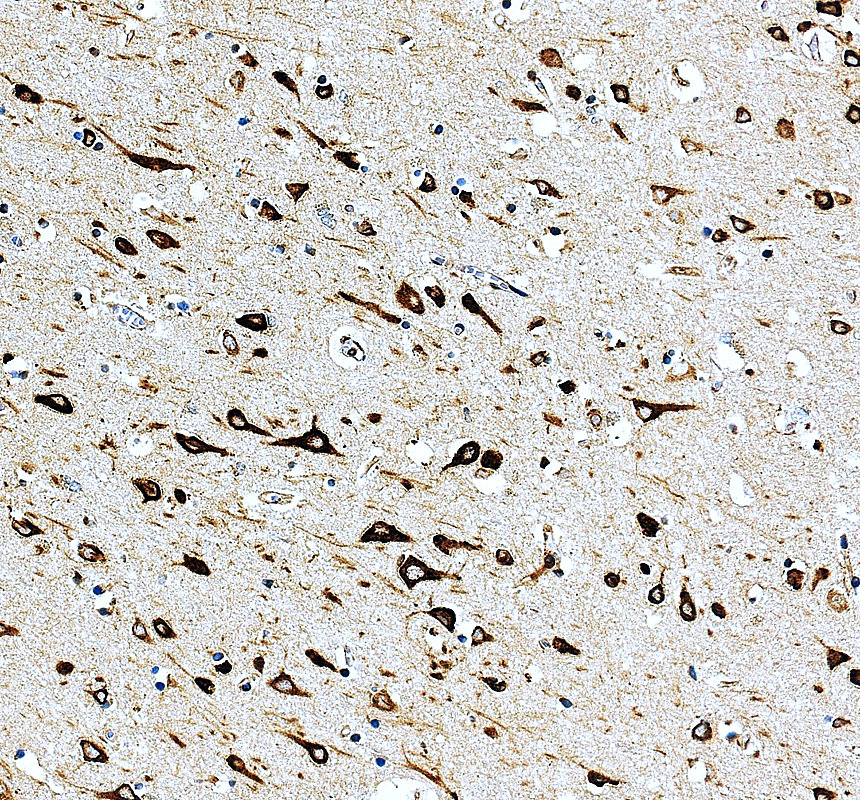 a07669 3 eef1b2 primary antibodies ihc testing 3