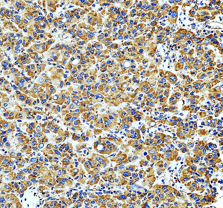 a07669 3 eef1b2 primary antibodies ihc testing 4