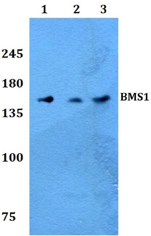 a07671 bms1 primary antiboties wb testing 1