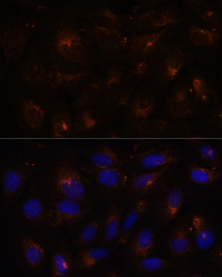 Immunofluorescence analysis of U-2 OS cells using ESYT1 antibody  at dilution of 1:100