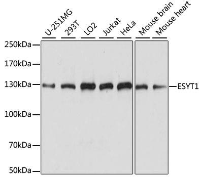 Western blot analysis of extracts of various cell lines, using ESYT1 antibody  at 1:1000 dilution