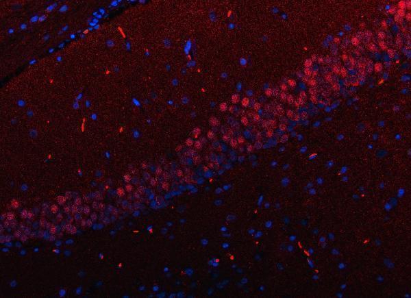 a07674 2 rfx3 primary antibodies if testing 5