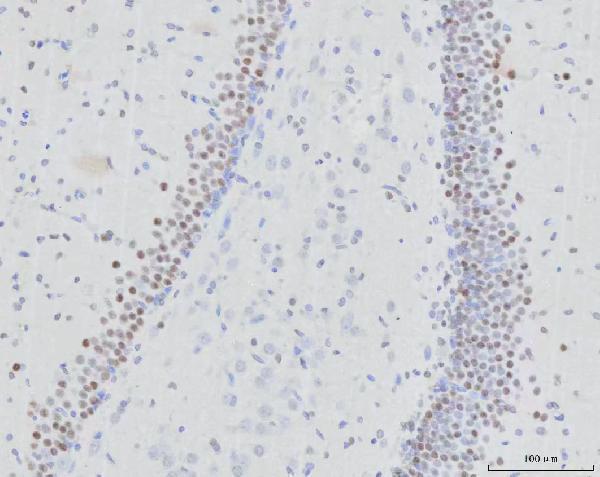 a07674 2 rfx3 primary antibodies ihc testing 3