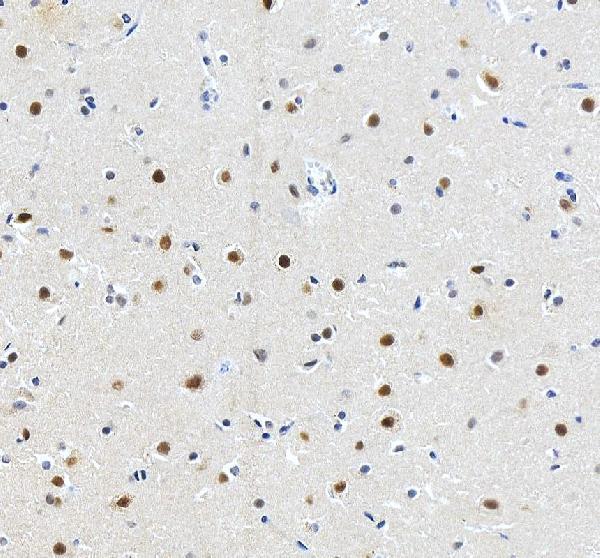 IHC analysis of RFX3 using anti-RFX3 antibody (A07674-2)