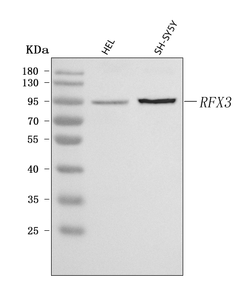  Western blot analysis of RFX3 using anti-RFX3 antibody (A07674-2)