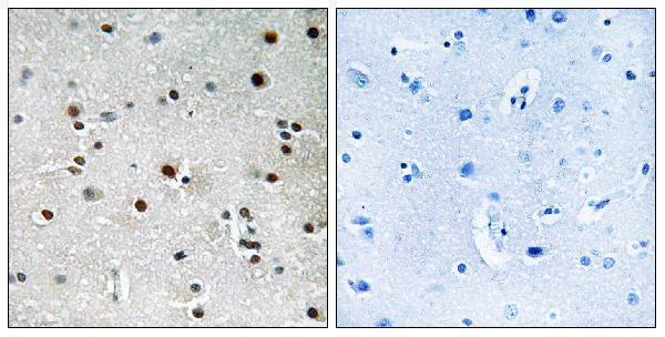 Immunohistochemistry analysis of paraffin-embedded human brain tissue, using RFX3 Antibody