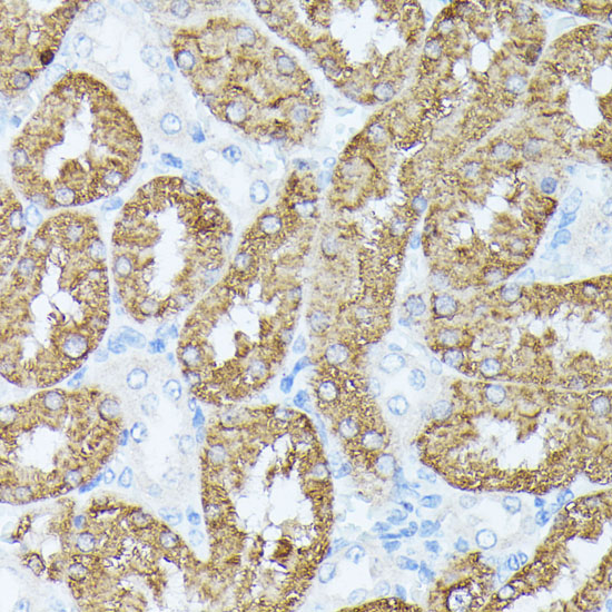 a07675 pls1 primary antiboties ihc testing 2