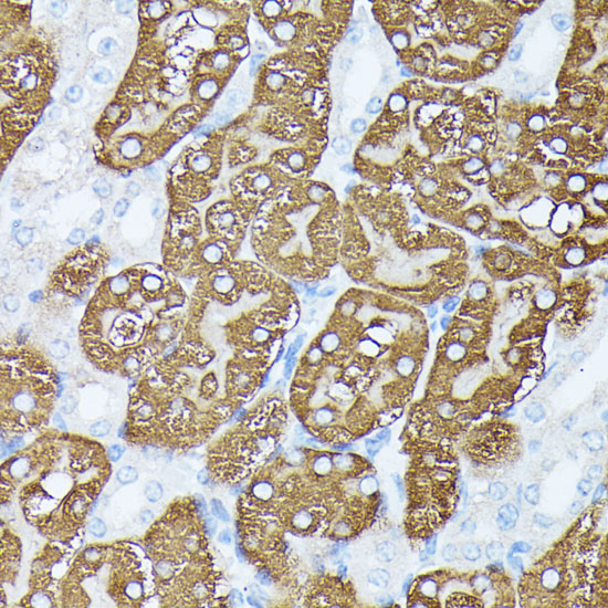 a07675 pls1 primary antiboties ihc testing 3